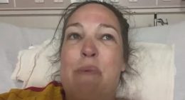 Shark attack victim in hospital bed.