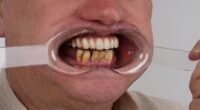 'I sawed out my rotting teeth with a shoelace-I thought it would be like shelling peas but I was very wrong'