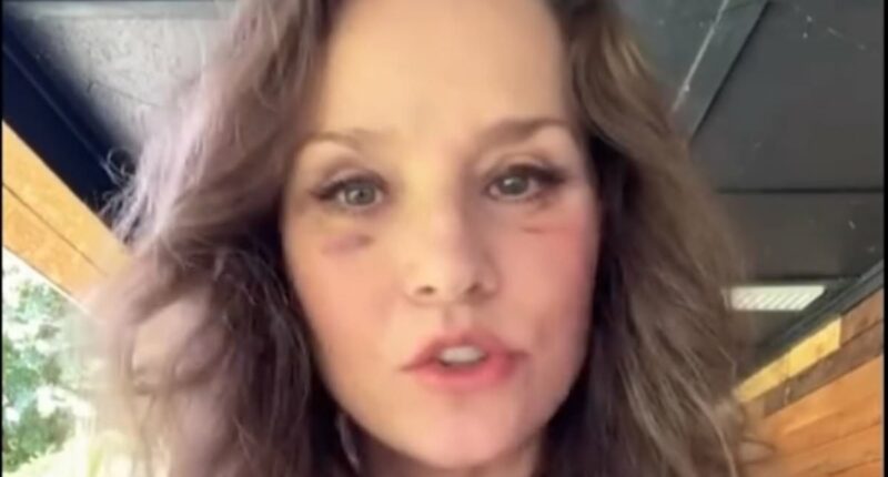 'I wish I'd known this before having a facelift': Grandmother who looks '20 years younger' has two big regrets