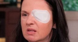 Beauty therapists must NOT give Botox, say experts - after illegal jabs leave 38 fighting for life and watchdog is accused of failing to act