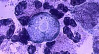 Child dies from brain-eating amoeba after doing favorite summertime activity