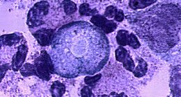 Child dies from brain-eating amoeba after doing favorite summertime activity