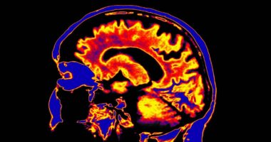 Dementia isn't a normal part of ageing - cut your risk by making these changes
