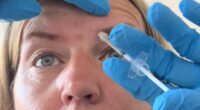 Doctors issue urgent warning over popular Botox treatment as they say women are taking 'ridiculous risks' and face paralysis, blindness and even death