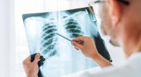 Experts discover alarming culprit behind mystery lung cancer surge in never-smokers... all Britons could be at risk