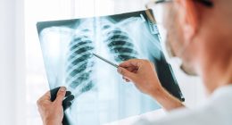 Experts discover alarming culprit behind mystery lung cancer surge in never-smokers... all Britons could be at risk