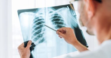 Experts discover alarming culprit behind mystery lung cancer surge in never-smokers... all Britons could be at risk