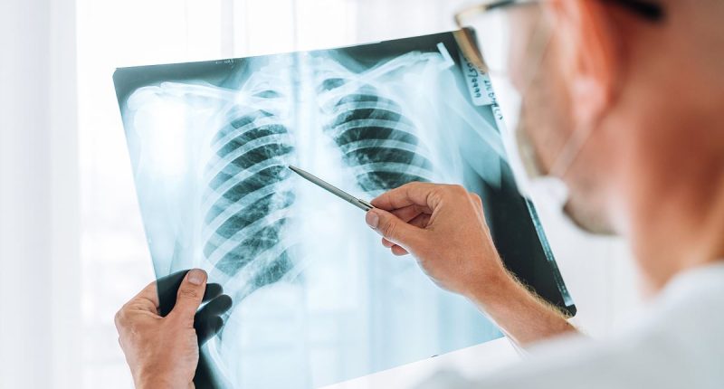 Experts discover alarming culprit behind mystery lung cancer surge in never-smokers... all Britons could be at risk