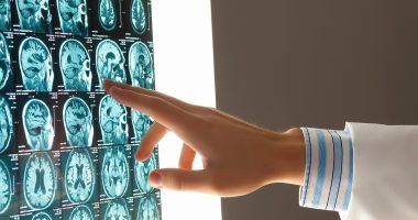 GP urges public to make one urgent change right now to ward off dementia in your 60s