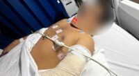 Man's arm 'hanging by a thread' after horror knife attack
