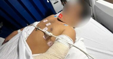 Man's arm 'hanging by a thread' after horror knife attack