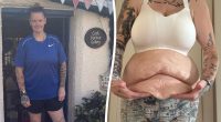 Mum lost 11st with Mounjaro - now she 'struggles to look at herself naked'