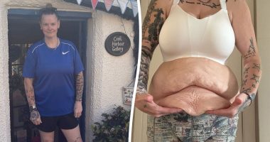 Mum lost 11st with Mounjaro - now she 'struggles to look at herself naked'