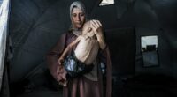 Reduced to skin and bones in Gaza: Horrifying story behind photo of starving child with a plastic bag as a nappy