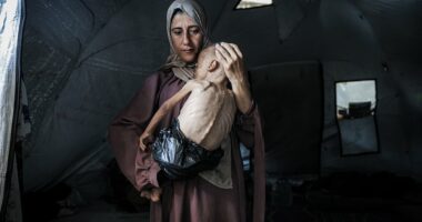 Reduced to skin and bones in Gaza: Horrifying story behind photo of starving child with a plastic bag as a nappy