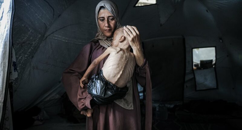 Reduced to skin and bones in Gaza: Horrifying story behind photo of starving child with a plastic bag as a nappy