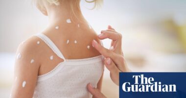 Sight of someone potentially infectious causes immune response, research suggests
