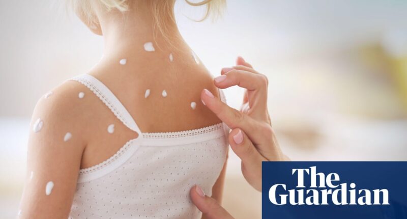 Sight of someone potentially infectious causes immune response, research suggests