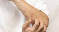 Stop insects from biting you by applying the 'CLOAK' trick