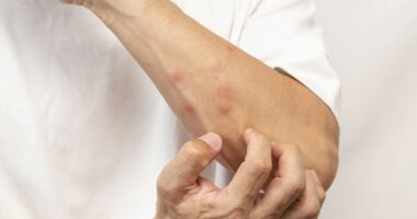 Stop insects from biting you by applying the 'CLOAK' trick