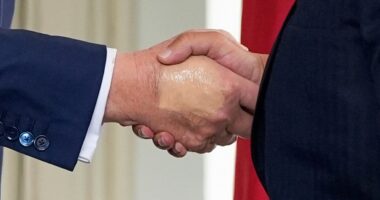 Trump undergoes medical exam for swelling in legs, hand bruising