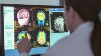 Two cancer drugs may reverse Alzheimer's brain changes — full study explained