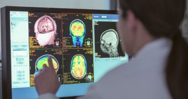 Two cancer drugs may reverse Alzheimer's brain changes — full study explained