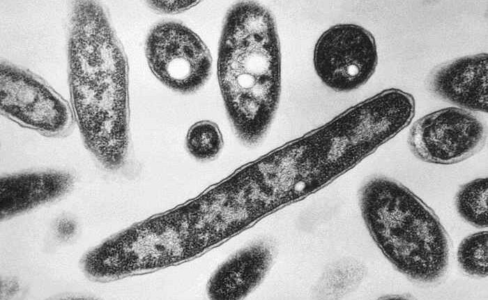 4th person dies after a Legionnaires’ disease outbreak sickens dozens in New York City