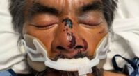 America's saddest man' beaten up and taken to LA hospital
