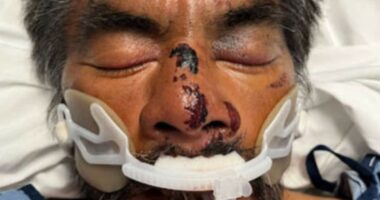 America's saddest man' beaten up and taken to LA hospital