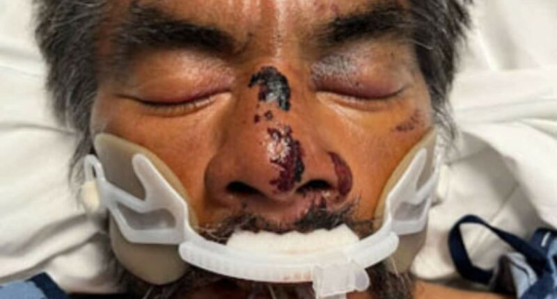 America's saddest man' beaten up and taken to LA hospital