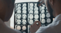 Brain injury drug