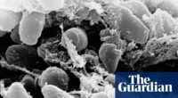 California resident tests positive for the plague after camping, officials say