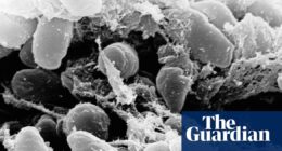 California resident tests positive for the plague after camping, officials say