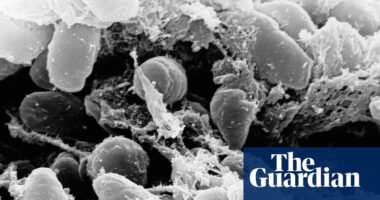 California resident tests positive for the plague after camping, officials say