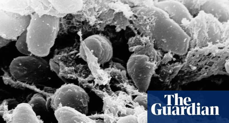 California resident tests positive for the plague after camping, officials say