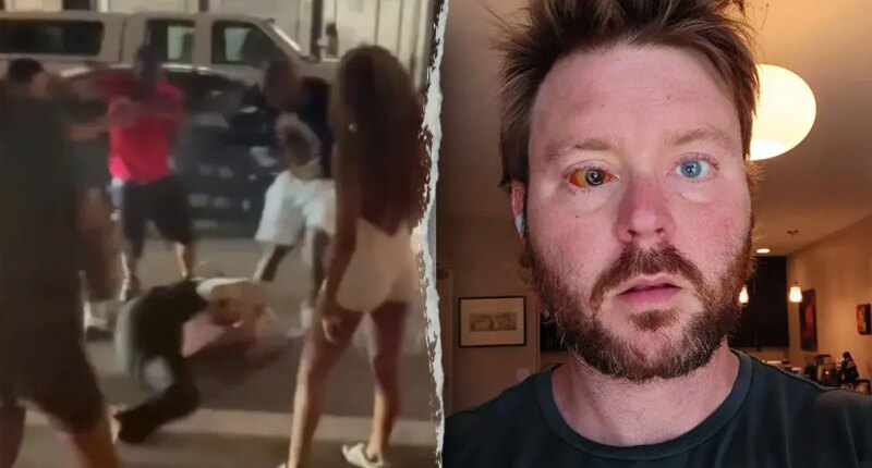 Cincinnati man who lost eye in unsolved random beating says crime 'out of control' after brutal viral assault