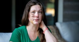 Cincinnati viral beating victim says violent mob started attacking 'like a pack of wolves'