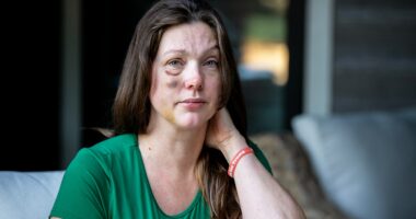Cincinnati viral beating victim says violent mob started attacking 'like a pack of wolves'