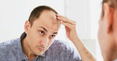 Drink enjoyed by millions every day 'could trigger hair loss'