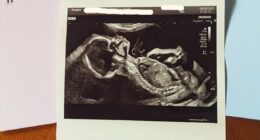 Emmerdale actress reveals she is expecting third child