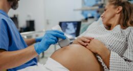 Experts issue warning as up to 53million Americans lead lifestyle that can raise risk of birth defects