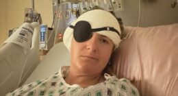 Fit and healthy young woman, 28, unknowingly lived with brain tumour for 15 YEARS - she suffered a single symptom