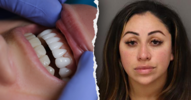 Florida woman arrested for unlicensed dental work allegedly used superglue on victims' teeth: police