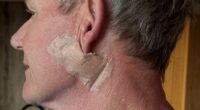 Gordon Ramsay reveals skin cancer scare
