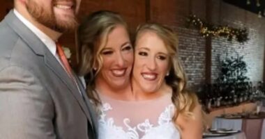 How do conjoined twins have a baby?
