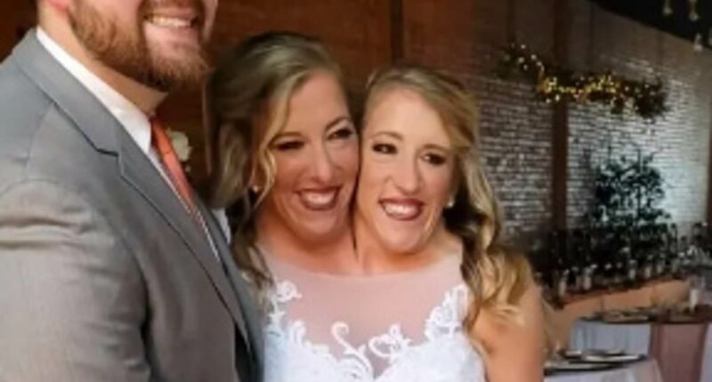 How do conjoined twins have a baby?