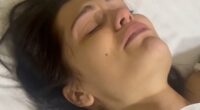 Jessie J shares heartbreaking moment she 'sobbed' over surgery scars
