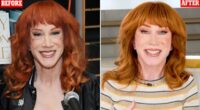 Kathy Griffin confirms she underwent THIRD face lift