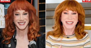 Kathy Griffin confirms she underwent THIRD face lift